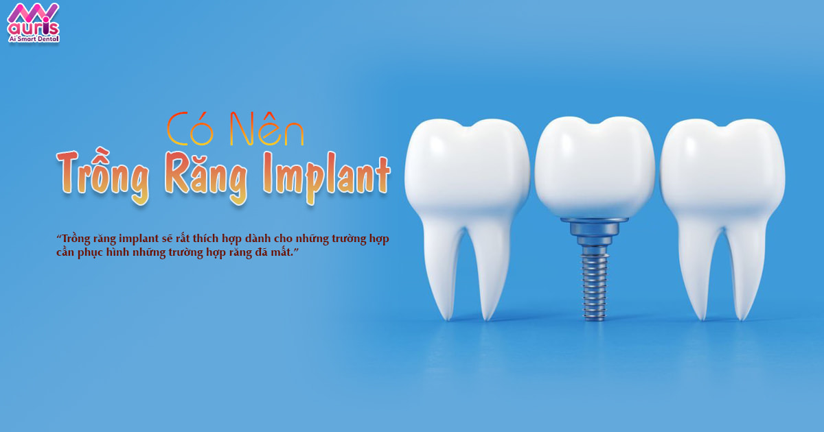 Có nên trồng răng implant không? Vì sao - Nha Khoa My Auris