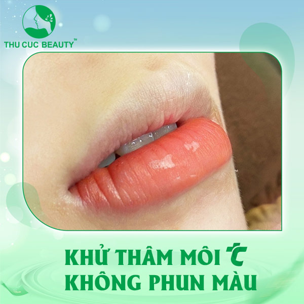 Khử thâm môi không phun màu - Thu Cúc Sài Gòn