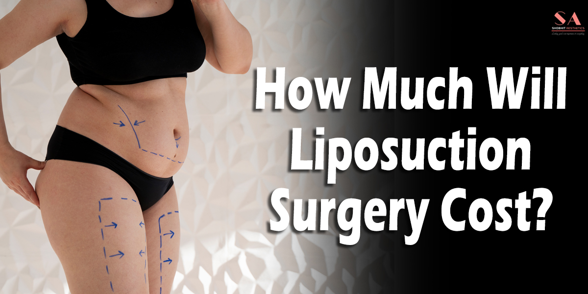 How Much will Liposuction Surgery Cost in Delhi India?