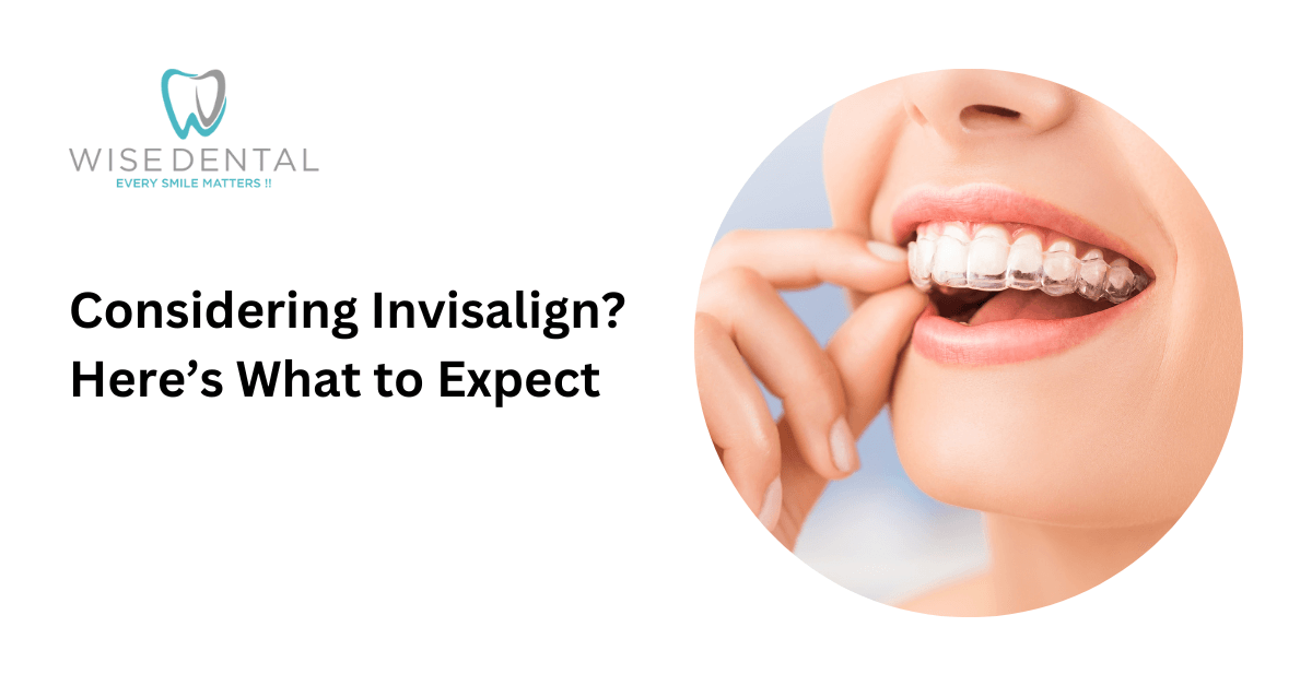 Considering Invisalign? Here’s What to Expect - Wise Dental