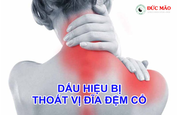 Thoát Vị Đĩa Đệm Đốt Sống Cổ: Dấu Hiệu, Biến Chứng Và Cách Điều Trị