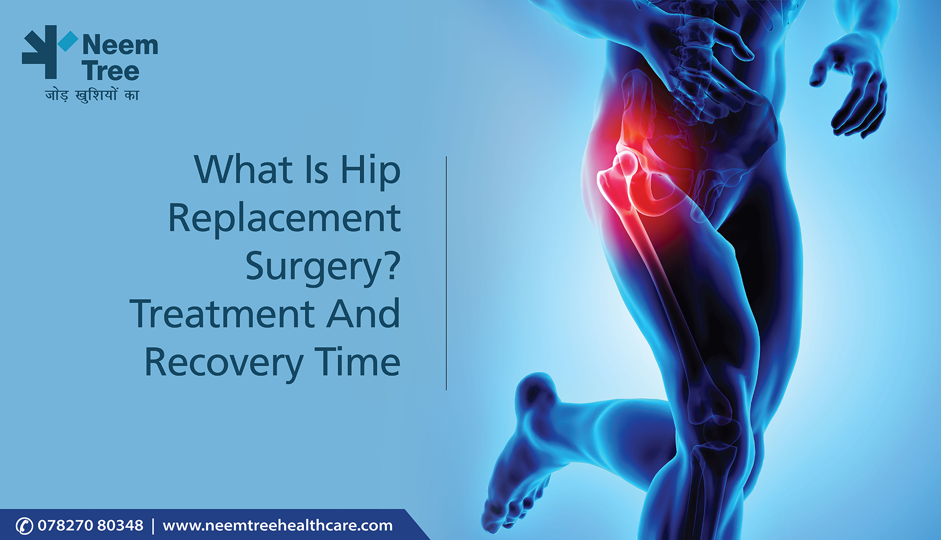 What Is Hip Replacement Surgery? Treatment And Recovery Time| NeemTree Healthcare-Orthopedic Centres