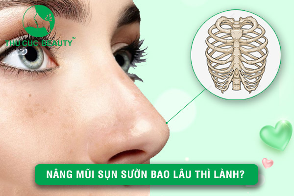 Nâng mũi sụn sườn bao lâu thì lành? - Thu Cúc Sài Gòn