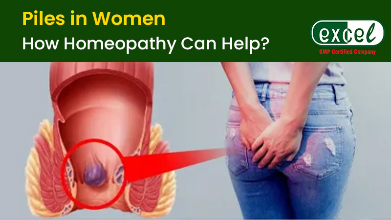 Piles in Women - How Homeopathy Can Help? - Excelebiz