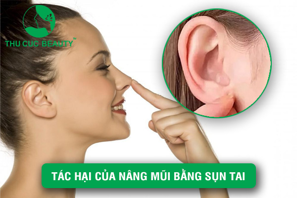 Tác hại của nâng mũi bằng sụn tai - Thu Cúc Sài Gòn