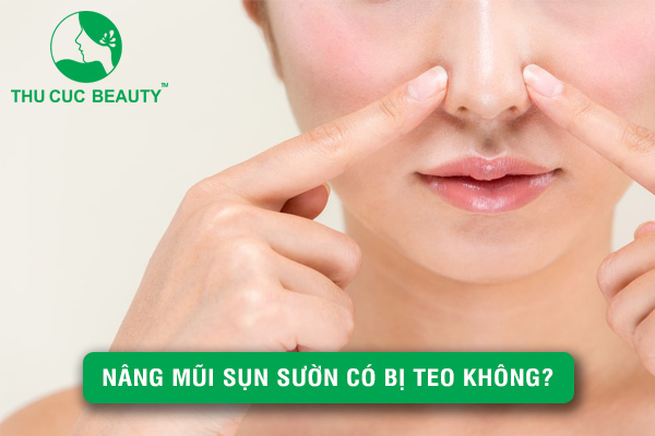 Nâng mũi sụn sườn có bị teo lại không? - Thu Cúc Sài Gòn