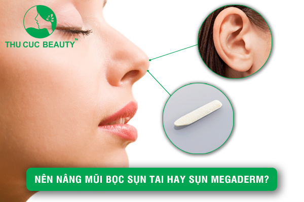 Nên nâng mũi bọc sụn tai hay sụn Megaderm?