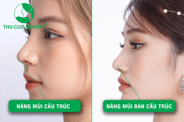 Nâng mũi cấu trúc và bán cấu trúc - Thu Cúc Sài Gòn