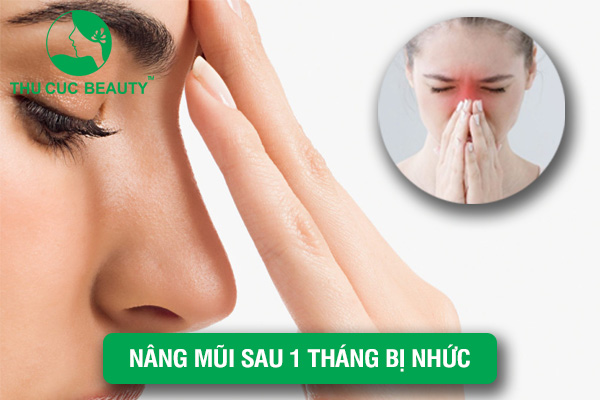 Nâng mũi sau 1 tháng bị nhức - Thu Cúc Sài Gòn