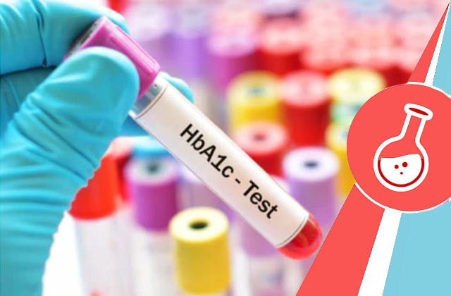 Book Glycosylated Hemoglobin Test | 30% Off On HbA1c Test Price