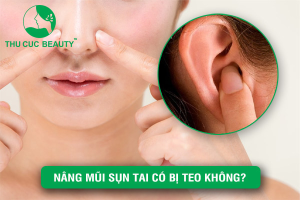 Nâng mũi sụn tai có bị teo không? - Thu Cúc Sài Gòn