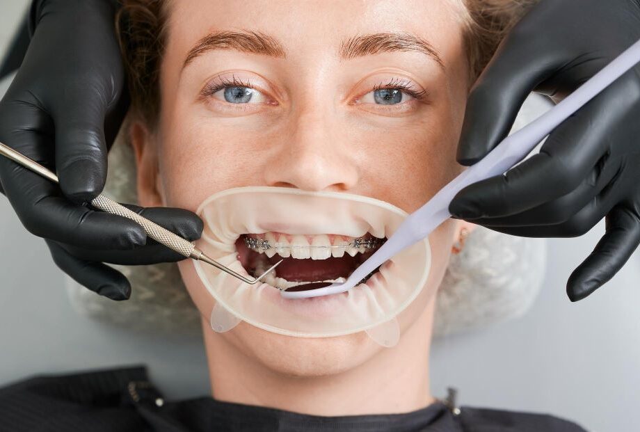 What Services Does a Dubai orthodontist Offer?