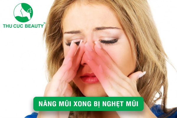 Nâng mũi xong bị nghẹt mũi - Biểu hiện và cách xử lý