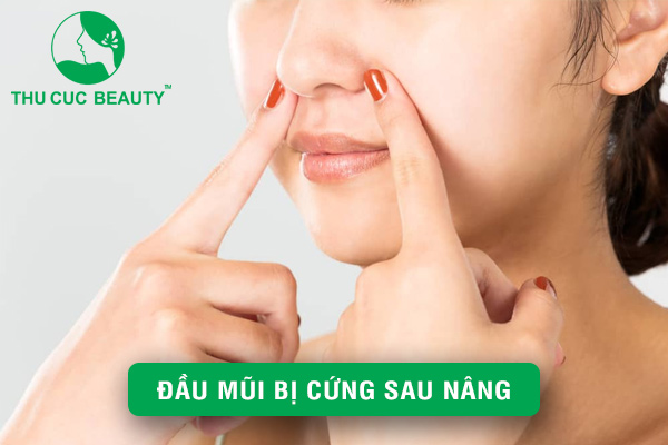 Đầu mũi bị cứng sau nâng - Nguyên nhân và cách xử lý