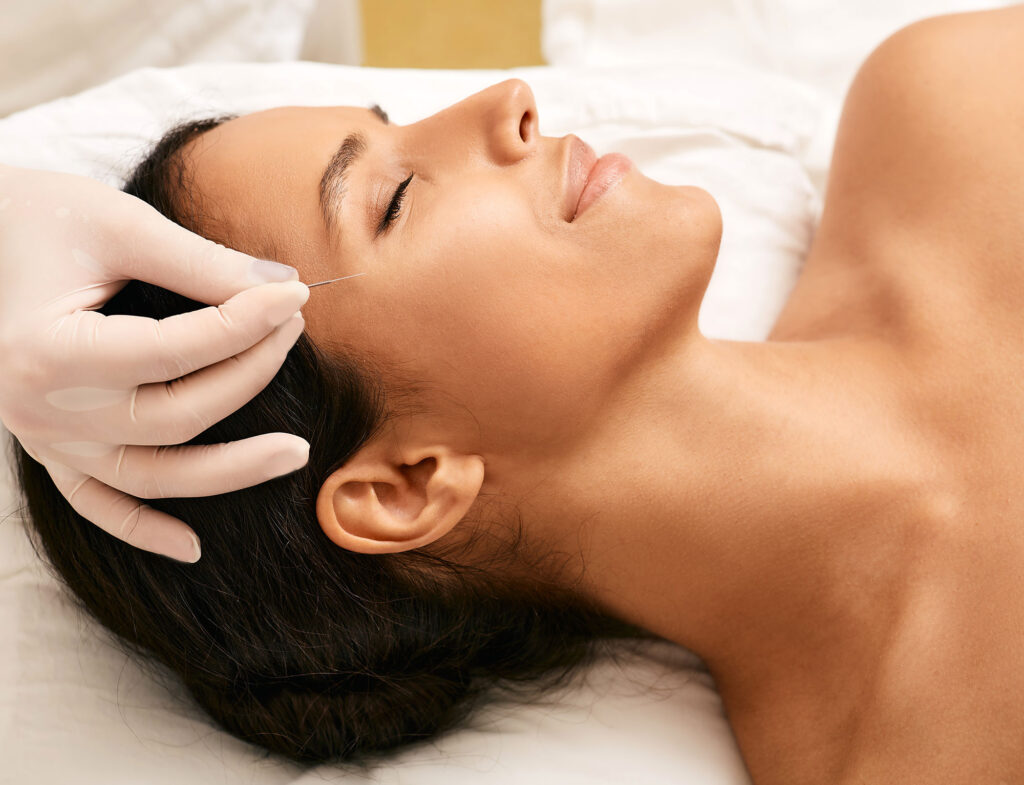San Diego Cosmetic Acupuncture - Natural & Non-Invasive Beauty Treatment
