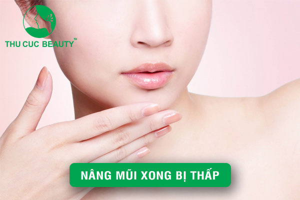 Nâng mũi xong bị thấp phải làm sao? - Thu Cúc Sài Gòn
