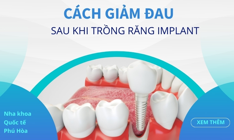 Trồng Răng Implant Có Đau Không? 7 cách giảm đau hiệu quả khi hết tê