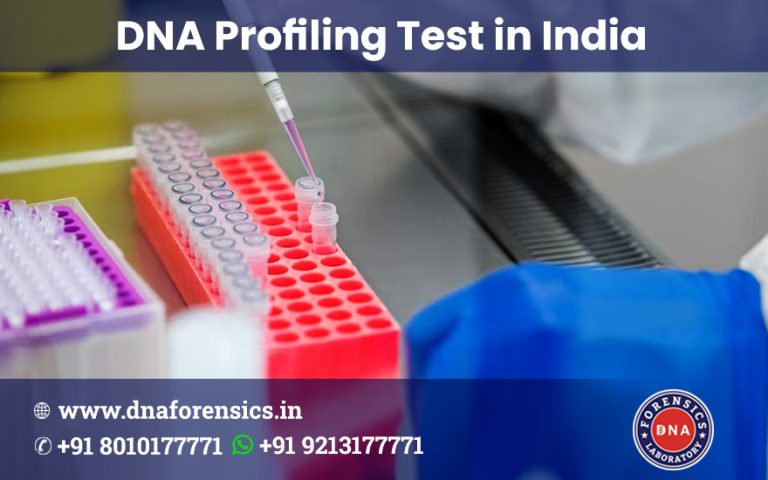 Applications of DNA Profiling Test for Legal and Peace of Mind Cases - WriteUpCafe.com