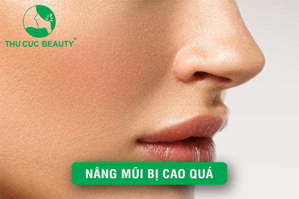Nâng mũi bị cao quá - Những ảnh hưởng cần lưu