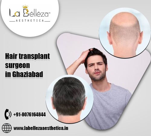 Unlocking Confidence: Finding the Best Hair Transplant Surgeon in Ghaziabad