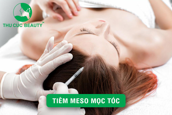 Tiêm meso mọc tóc - Hiệu quả bất ngờ sau 1 liệu trình
