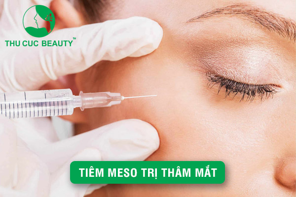 Tiêm meso trị thâm mắt - Giải pháp an toàn và hiệu quả