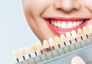 Revitalize Your Smile: The Magic of Dental Veneers