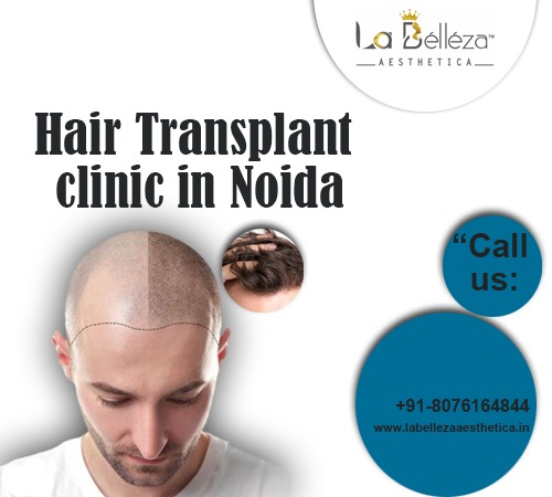 Transform Your Look: A Guide to Choosing the Right Hair Transplant Clinic in Noida