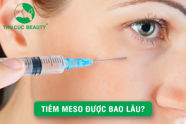Tiêm Meso được bao lâu? - Thu Cúc Sài Gòn