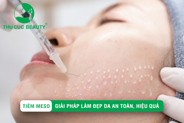 Tiêm Meso là gì? Tiêm Meso loại nào an toàn và hiệu quả
