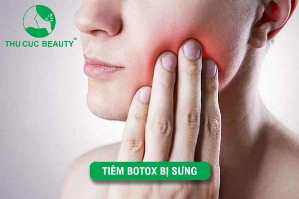 Tiêm Botox bị sưng: Cách ngăn ngừa an toàn và hiệu quả