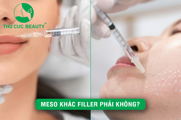 Meso khác Filler phải không? - Thu Cúc Sài Gòn