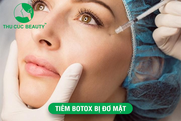 Tiêm Botox bị đơ mặt: Nguyên nhân và biện pháp xử lý