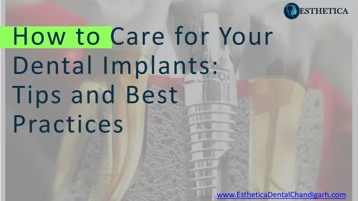PPT - How to Care for Your Dental Implants Tips and Best Practices PowerPoint Presentation - ID:12831632