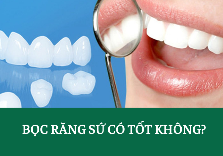 BỌC RĂNG SỨ CÓ TỐT KHÔNG? - REVIEWNHAKHOA