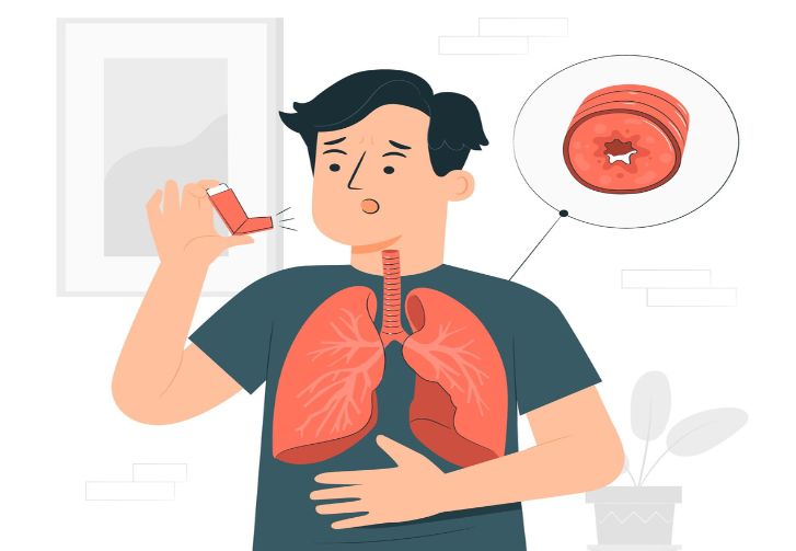 Understanding Asthma: Causes, Symptoms & Effective Management - Latest Trending Technology Blogs - Tech Planet News