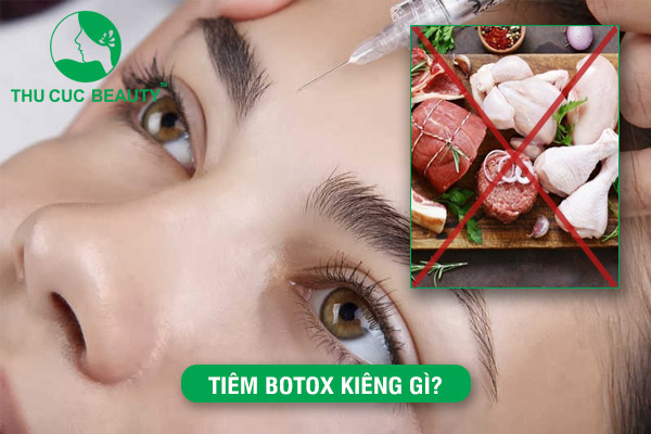 Sau khi tiêm Botox kiêng gì? Nên kiêng trong bao lâu?