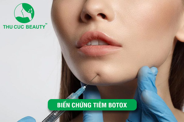 Biến chứng tiêm Botox và cách xử lý nhanh chóng, hiệu quả