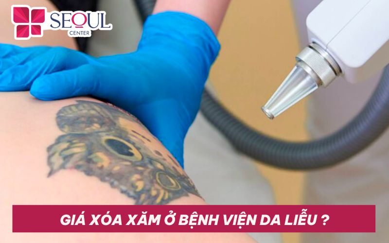 Giá xóa xăm ở bệnh viện da liễu bao nhiêu? Xóa xăm ở đâu uy tín?