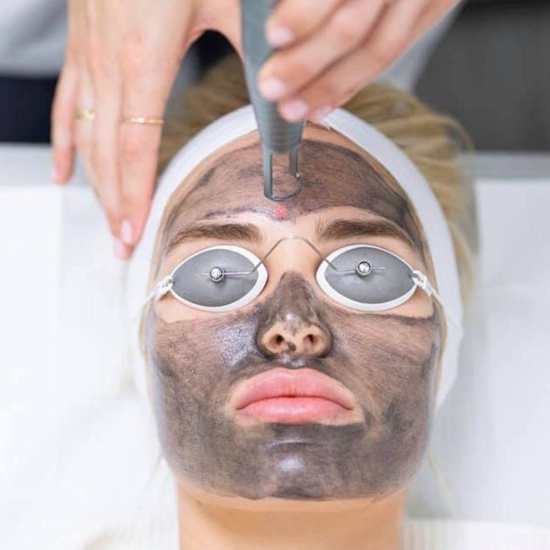 Carbon Laser Treatment in Chandigarh - Esthetica