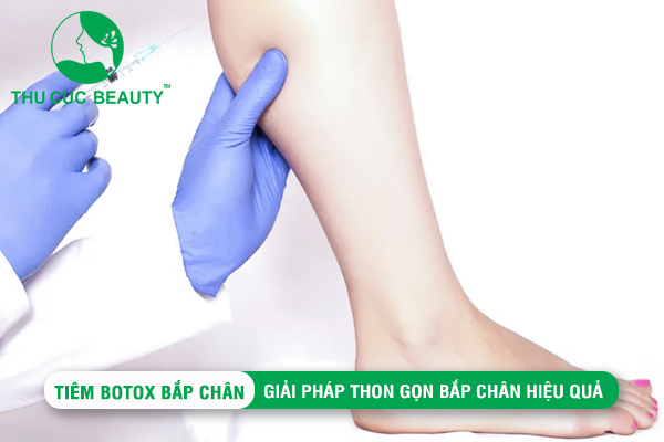 Tiêm Botox bắp chân: Giải pháp thon gọn bắp chân hiệu quả