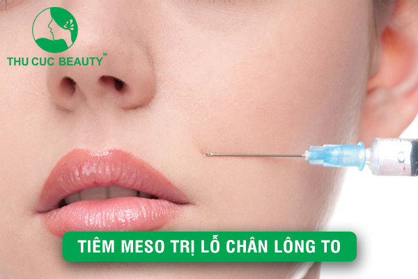 Tiêm Meso trị lỗ chân lông to: Giải pháp an toàn, hiệu quả