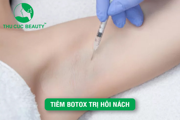 Tiêm Botox trị hôi nách: Giải pháp an toàn và hiệu quả