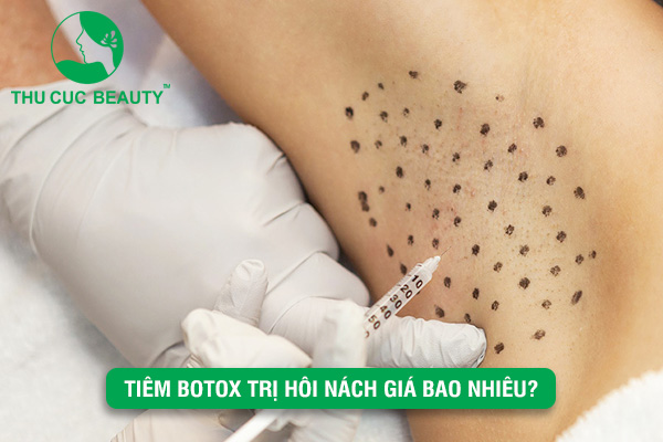 Tiêm Botox trị hôi nách giá bao nhiêu? - Thu Cúc Sài Gòn