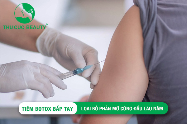 Tiêm Botox bắp tay - Đánh tan mỡ thừa cứng đầu lâu năm