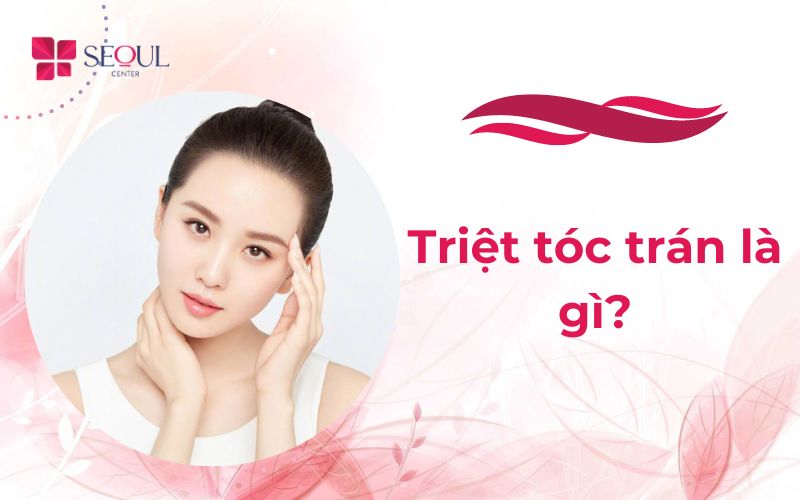 Triệt tóc trán là gì? Có hiệu quả không? Cách nào hiệu quả?