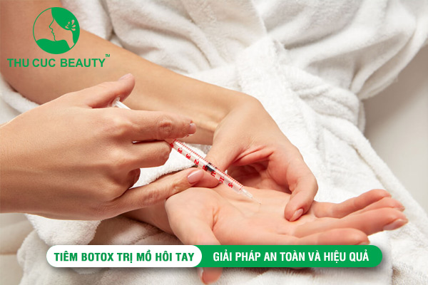 Tiêm Botox trị mồ hôi tay: Giải pháp an toàn và hiệu quả