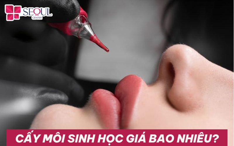 Cấy môi sinh học giá bao nhiêu? Bảng giá cấy môi 2024