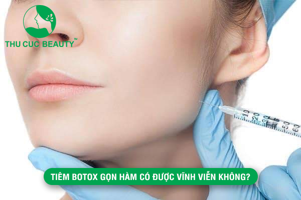 Tiêm Botox gọn hàm có được vĩnh viễn không?