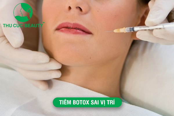 Tiêm Botox sai vị trí có nguy hiểm không? - Thu Cúc Sài Gòn